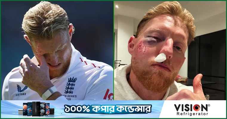 বলের আঘাতে স্টোকসের চোখে-মুখে গুরুতর চোট